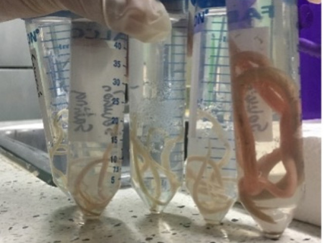 Ascaris lumbicoides in verschiedenen Grössen, je nach Alter des Parasiten.